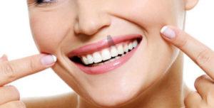 implants | Centre Dental Cise