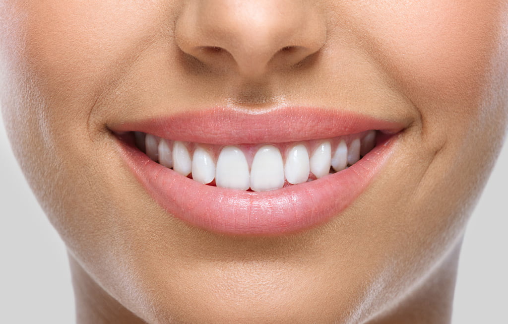 Estética dental a Figueres